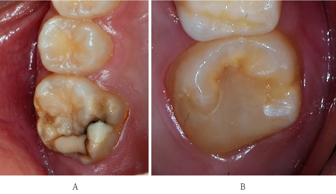 Figure 11.