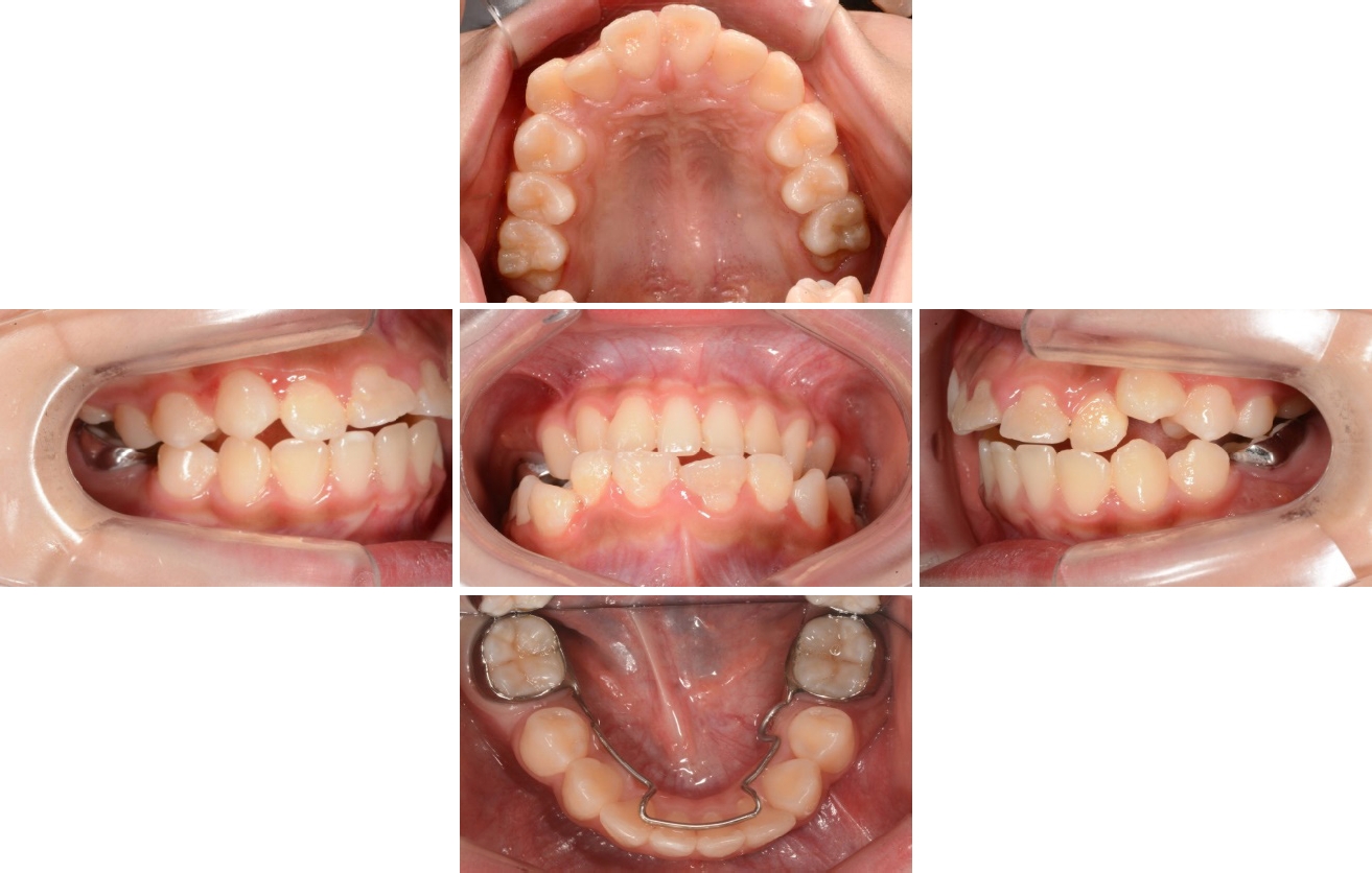 Figure 12.